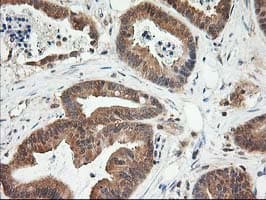 Monoclonal Mouse anti-Human LSM1 Antibody (clone OTI5C6, IHC, IF, WB)