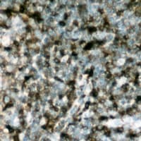 Polyclonal Rabbit anti-Human NCF1 / p47phox / p47 phox Antibody (C-Terminus, IHC, WB)