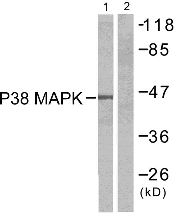 Polyclonal Rabbit anti-Human MAPK14 / p38 Antibody (p180, WB)