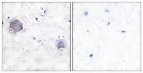 NOTCH1 Antibody (aa1735-1784)