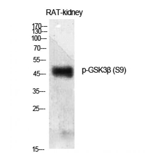 GSK3B / GSK3 Beta Antibody (1-80 aa)