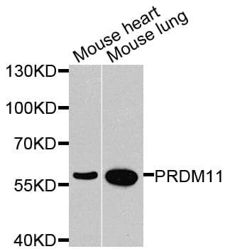PRDM11 Antibody