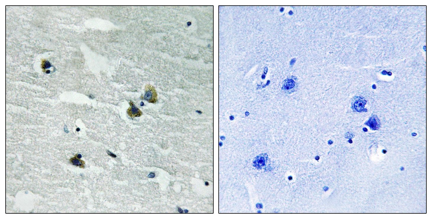 MER / MERTK Antibody (phospho-Tyr749/681)