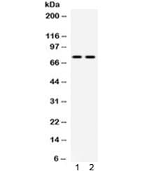 Polyclonal Rabbit anti-Mouse ZBTB7A / Pokemon Antibody (IHC, WB)