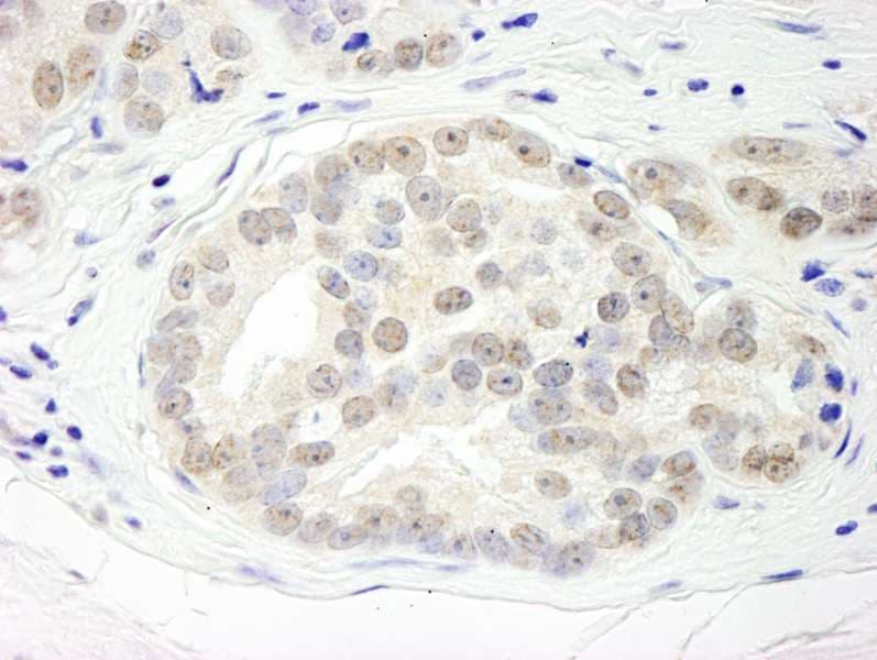 Polyclonal Rabbit anti-Human DHX15 Antibody (aa350-400, IHC, WB)