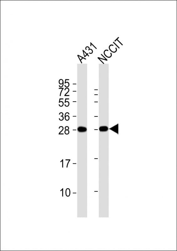 BCAP31 / BAP31 Antibody (clone 1502CT208.31.16)