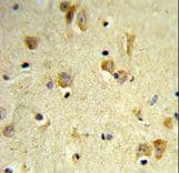 Polyclonal Rabbit anti-Human PEX14 Antibody (aa343-370, IHC, WB)