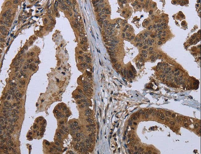 Polyclonal Rabbit anti-Human GOLGA2 / GM130 Antibody (IHC, WB)
