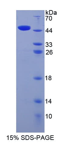 Mouse ITGA2 / CD49b Protein (Recombinant His-GST-S)