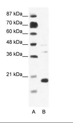 Polyclonal Rabbit anti-Human CACNG1 / CACNG Antibody (aa66-115, IHC, WB)
