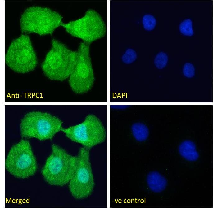 IHC-plus™ TRPC1 Antibody (aa722-733)