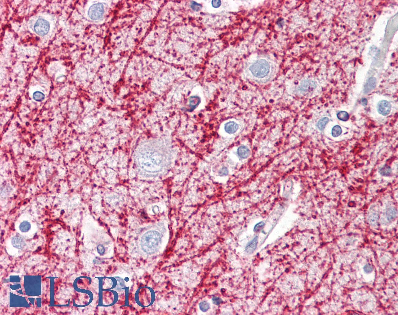 IHC-plus™ Polyclonal Rabbit anti-Human TNFSF13 / APRIL Antibody (aa151-200, IHC, IF, WB)