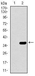 SLC27A5 / BACS Antibody (Amino Acid: 508-570, clone 4B11C10)