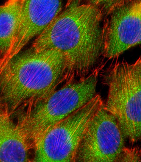 Polyclonal Rabbit anti-Human AKT2 Antibody (aa416-444, IHC, IF, WB)