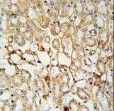 KCNV1 / Kv8.1 Antibody (aa137-166)