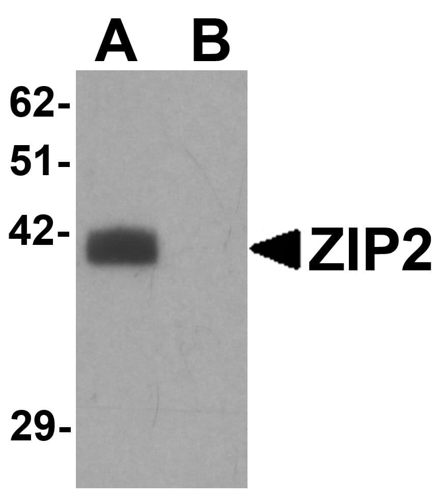 SLC39A2 / ZIP2 Antibody