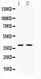 DCX / Doublecortin Antibody