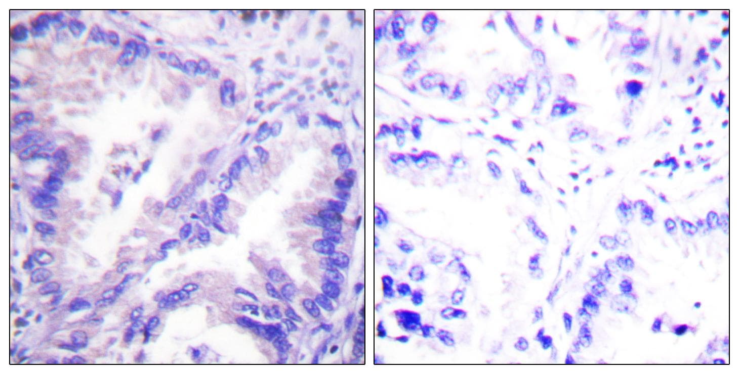 PP2Ac / PPP2CA Antibody (p307)