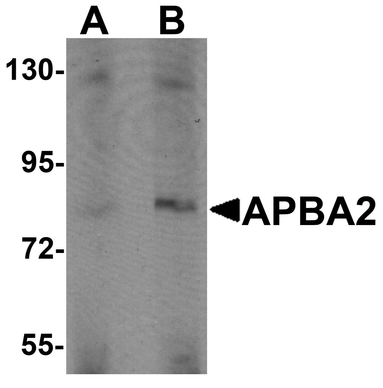 IHC-plus™ APBA2 Antibody