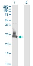 Monoclonal Mouse anti-Human SNAP23 / SNAP-23 Antibody (clone 2F5-3D4, IHC, WB)
