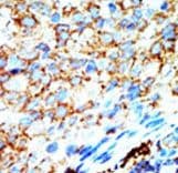 NME4 Antibody (aa158-187)