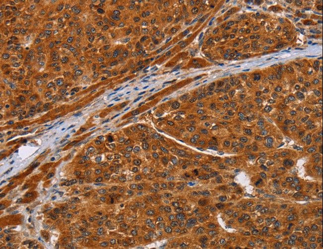 ALS2CR1 / NIF3L1 Antibody
