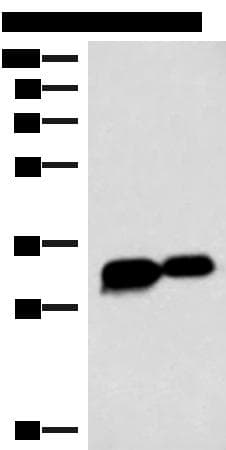 HCCS Antibody
