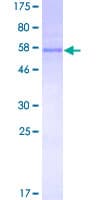 Human TREX1 Protein (Recombinant GST)