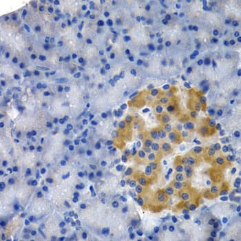 Polyclonal Rabbit anti-Human HSPB8 / H11 / HSP22 Antibody (IHC, IF, WB)