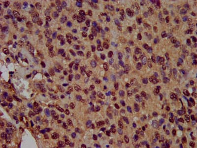 HIST1H3A Antibody