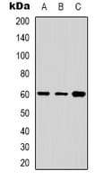 CYP24 / CYP24A1 Antibody (C-Terminus)