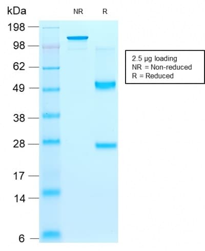 PathPlus™ Recombinant Monoclonal Mouse anti-Human CD44 Antibody (clone rCD44v9/1459, IHC)