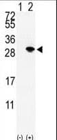 Polyclonal Rabbit anti-Human SUMO2 + SUMO3 Antibody (aa38-64, WB)