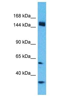 Polyclonal Rabbit anti-Human CCDC144A Antibody (aa1271-1320, WB)