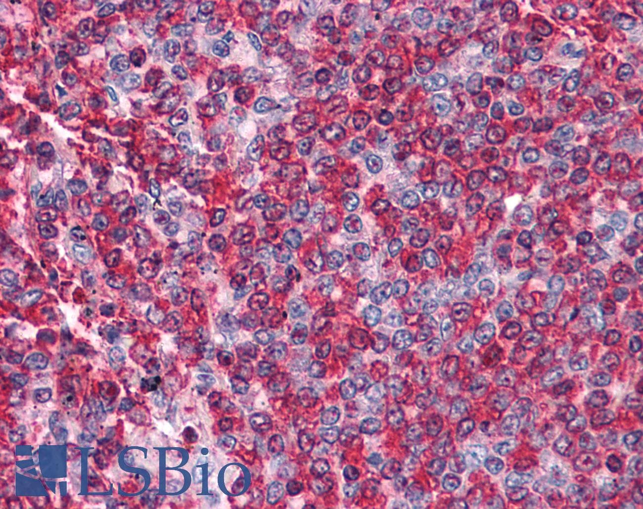 IHC-plus™ BCAS2 Antibody
