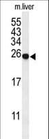 Polyclonal Rabbit anti-Human SPR Antibody (aa231-260, WB)