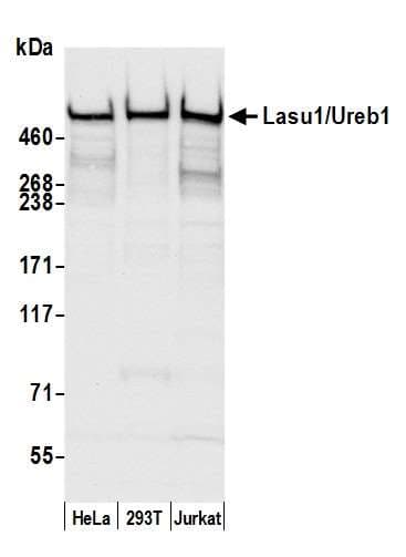 HUWE1 / ARFBP1 Antibody (aa2250-2300)