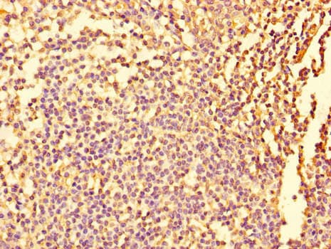 FIGN / Fidgetin Antibody