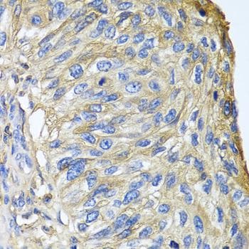 Polyclonal Rabbit anti-Human APOA1 / Apolipoprotein A 1 Antibody (IHC, IF, WB)