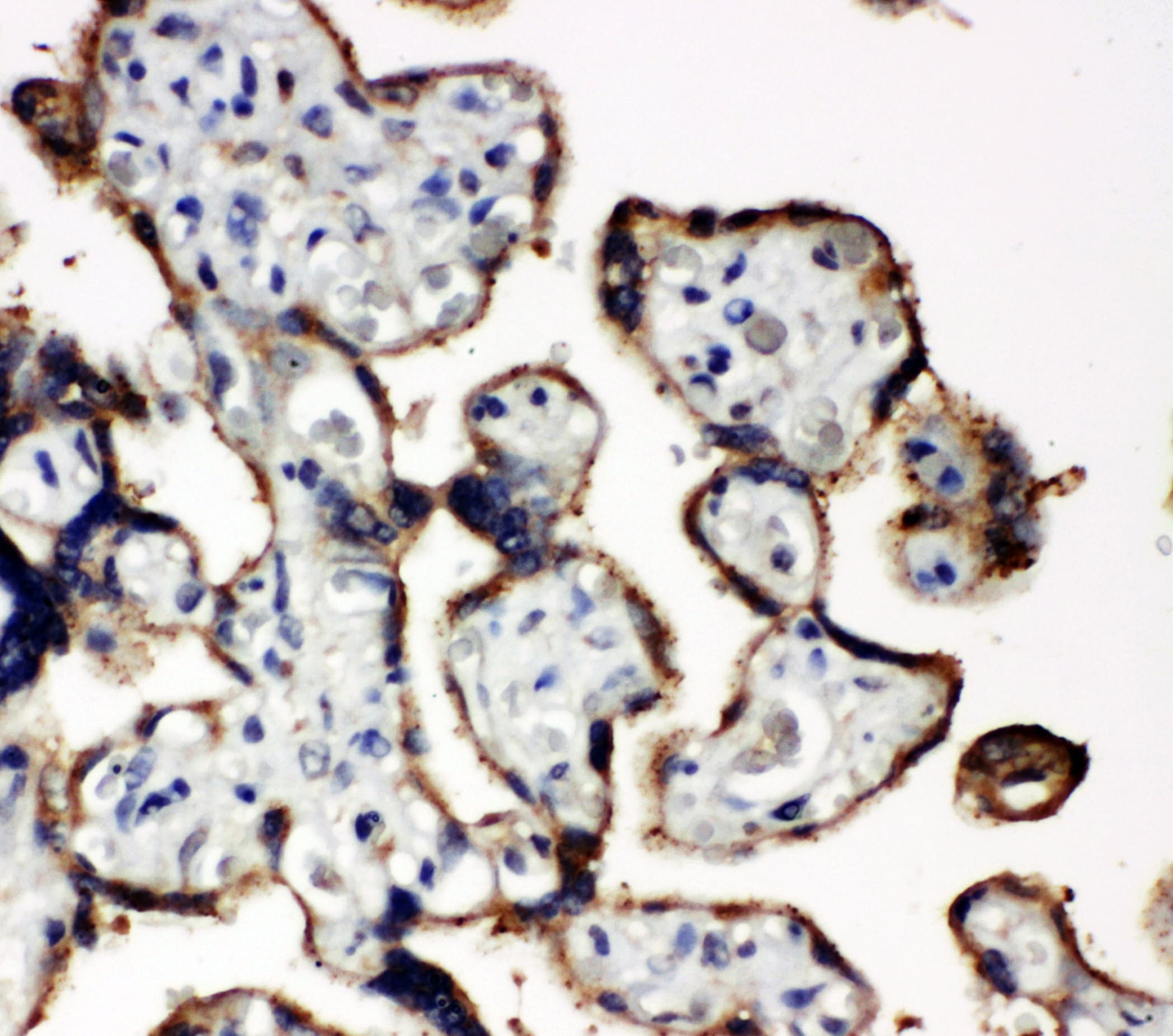 EIF2S1 Antibody (aa123-137)