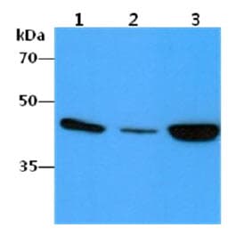PathPlus™ ACTA2 / Smooth Muscle Actin Antibody (clone AT132D3)