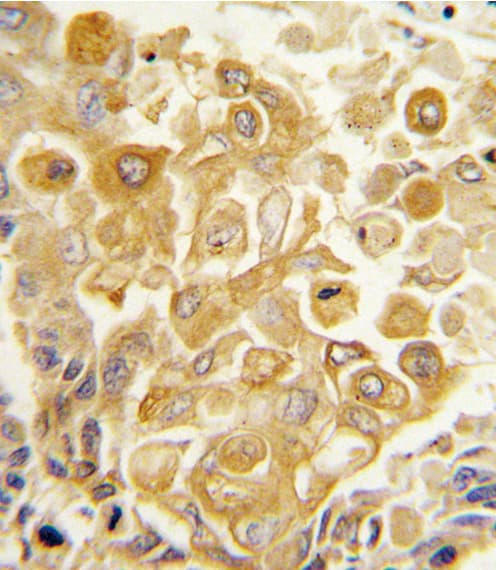 TLR2 Antibody (aa212-242)