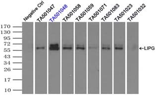 Monoclonal Mouse anti-Human LIPG / Endothelial Lipase Antibody (clone OTI8E4, IHC, IF, WB)