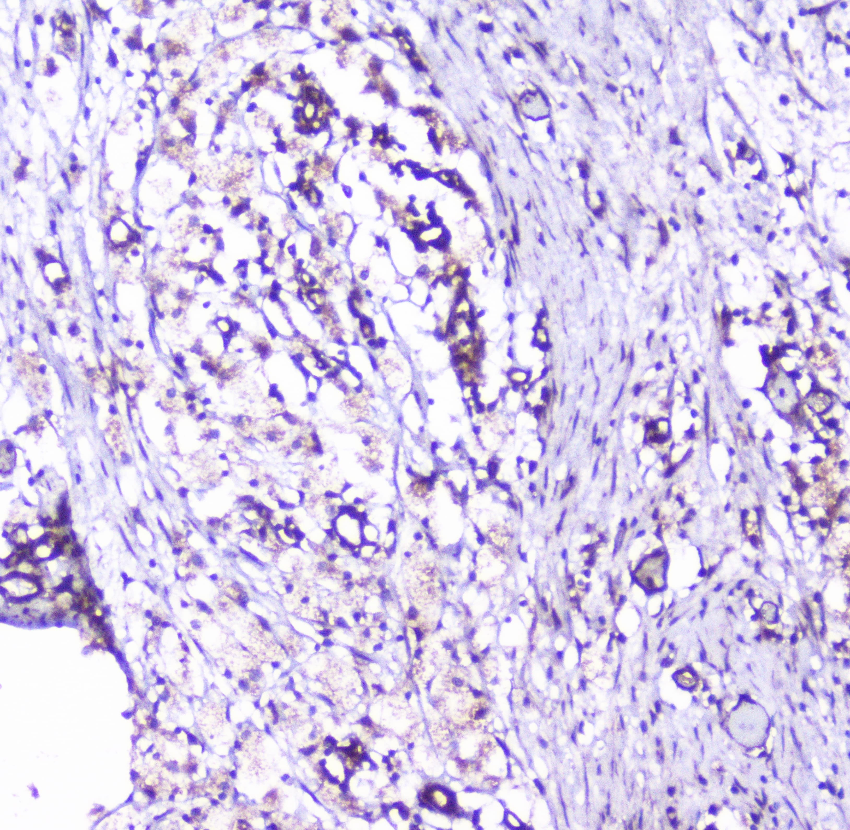 CTTN / Cortactin Antibody