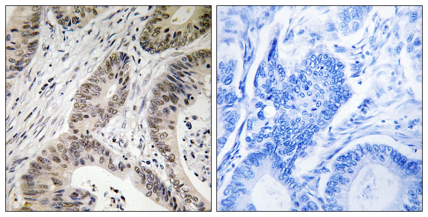 Polyclonal Rabbit anti-Human TUT1 Antibody (aa291-340, IHC)