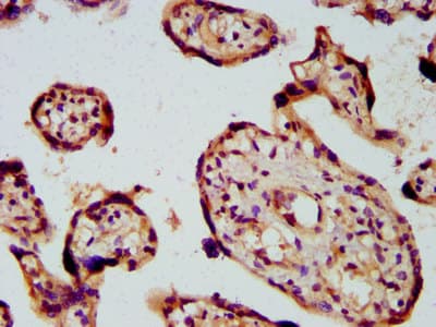 PICALM / CALM Antibody