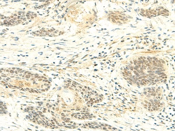 ATMIN Antibody