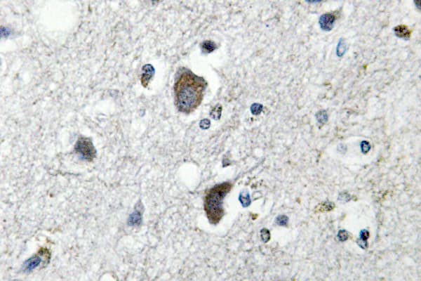 Polyclonal Rabbit anti-Human HSP70 / Heat Shock Protein 70 Antibody (Phe245, IHC, WB)