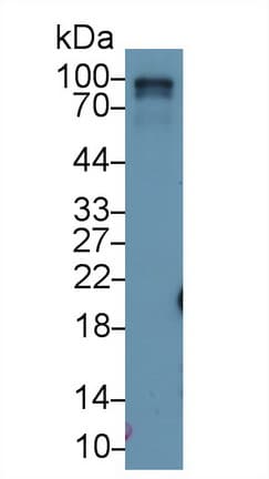 RIP1 / RALBP1 Antibody (aa527-626, Biotin)