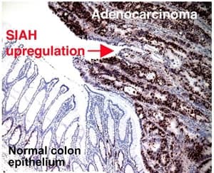 SIAH2 Antibody (N-Terminus, clone 24E6H3)